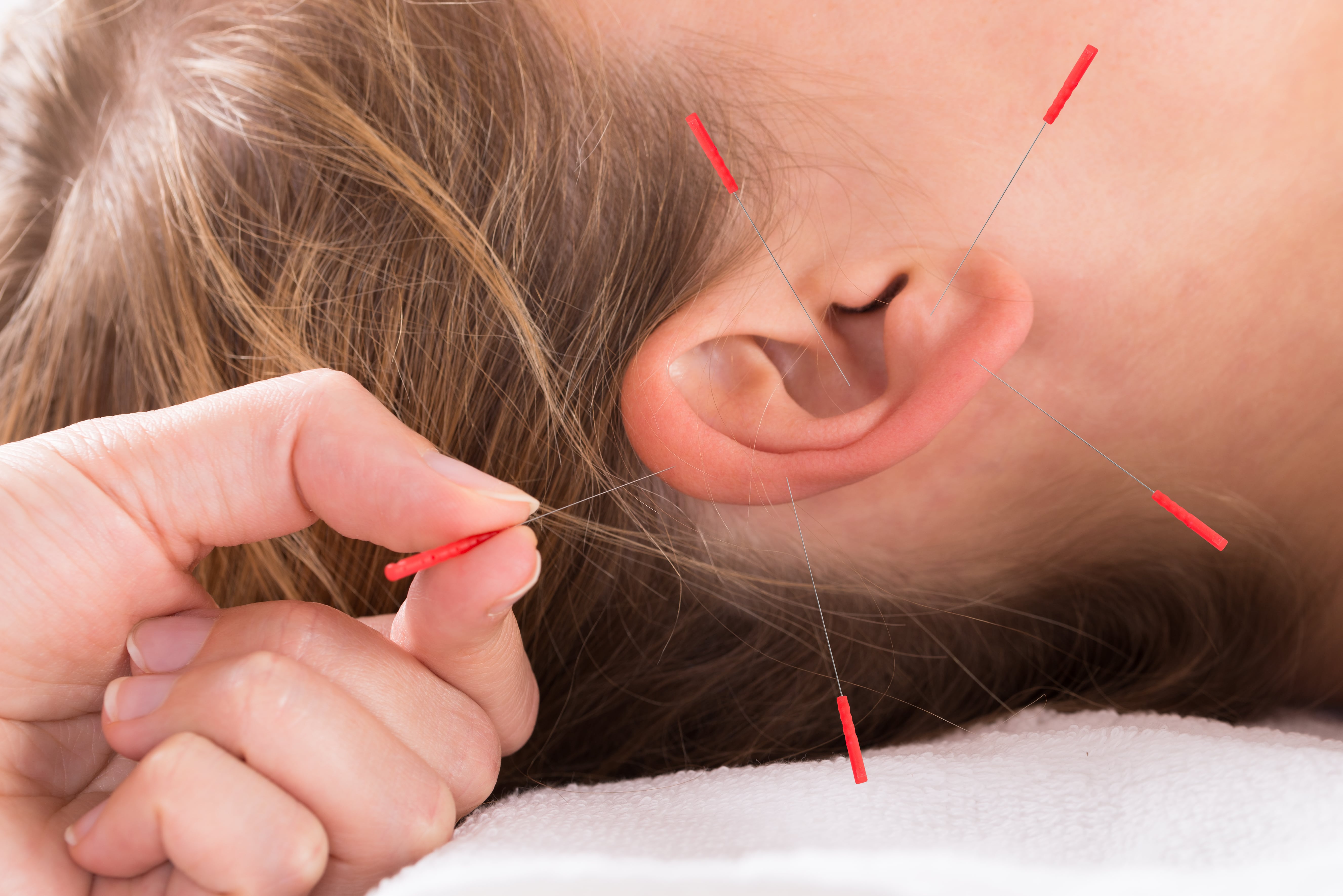 Auricular Therapy